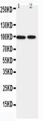 Erythrocyte Membrane Protein Band 4.1 Like 1 antibody, PA5-79205, Invitrogen Antibodies, Western Blot image 