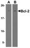 BCL2 antibody, GTX31687, GeneTex, Western Blot image 