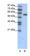 Integrin Linked Kinase antibody, orb329572, Biorbyt, Western Blot image 