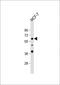 Apurinic/Apyrimidinic Endodeoxyribonuclease 2 antibody, GTX80642, GeneTex, Western Blot image 