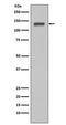 Minichromosome Maintenance Complex Component 2 antibody, M00374, Boster Biological Technology, Western Blot image 