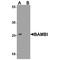BMP And Activin Membrane Bound Inhibitor antibody, TA349085, Origene, Western Blot image 
