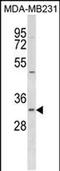 Fumarylacetoacetate Hydrolase Domain Containing 2B antibody, PA5-49012, Invitrogen Antibodies, Western Blot image 