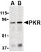 Eukaryotic Translation Initiation Factor 2 Alpha Kinase 2 antibody, LS-B1352, Lifespan Biosciences, Western Blot image 