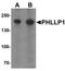 PH Domain And Leucine Rich Repeat Protein Phosphatase 1 antibody, LS-B8860, Lifespan Biosciences, Western Blot image 