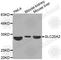 Solute Carrier Family 25 Member 2 antibody, A3519, ABclonal Technology, Western Blot image 