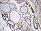 Meis Homeobox 1 antibody, LS-C795045, Lifespan Biosciences, Immunohistochemistry paraffin image 