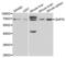 Zeta Chain Of T Cell Receptor Associated Protein Kinase 70 antibody, abx001807, Abbexa, Western Blot image 