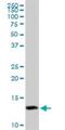 Translocase Of Inner Mitochondrial Membrane 8A antibody, H00001678-B01P, Novus Biologicals, Western Blot image 