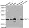 Proteasome Inhibitor Subunit 1 antibody, LS-C334133, Lifespan Biosciences, Western Blot image 