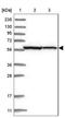 Zinc finger protein 354C antibody, NBP1-81352, Novus Biologicals, Western Blot image 