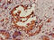 SUMO Specific Peptidase 2 antibody, CSB-PA888026LA01HU, Cusabio, Immunohistochemistry paraffin image 