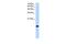 Basic Leucine Zipper ATF-Like Transcription Factor 2 antibody, GTX48895, GeneTex, Western Blot image 