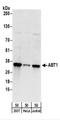 Activator Of Basal Transcription 1 antibody, NBP2-22332, Novus Biologicals, Western Blot image 