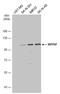 OCRL Inositol Polyphosphate-5-Phosphatase antibody, GTX117067, GeneTex, Western Blot image 