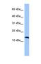 Parathyroid Hormone 2 antibody, NBP1-69679, Novus Biologicals, Western Blot image 