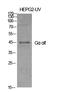 G Protein Subunit Alpha L antibody, STJ93458, St John