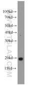 Pyroglutamyl-Peptidase I antibody, 19566-1-AP, Proteintech Group, Western Blot image 