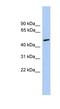 Cholinergic Receptor Nicotinic Alpha 5 Subunit antibody, NBP1-69122, Novus Biologicals, Western Blot image 