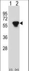 Protein Kinase CAMP-Dependent Type II Regulatory Subunit Beta antibody, LS-C162153, Lifespan Biosciences, Western Blot image 