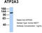 ATPase Sarcoplasmic/Endoplasmic Reticulum Ca2+ Transporting 3 antibody, TA339001, Origene, Western Blot image 