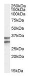 G Protein-Coupled Receptor 3 antibody, orb19598, Biorbyt, Western Blot image 
