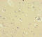 Thioredoxin Domain Containing 8 antibody, LS-C394648, Lifespan Biosciences, Immunohistochemistry paraffin image 