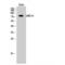 Leucine Rich Repeat Containing 41 antibody, LS-C384368, Lifespan Biosciences, Western Blot image 