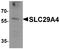 Solute Carrier Family 29 Member 4 antibody, A07453, Boster Biological Technology, Western Blot image 