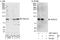 PHD Finger Protein 21A antibody, NBP2-04043, Novus Biologicals, Immunoprecipitation image 