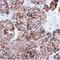 Cytokeratin Pan  antibody, NBP2-33200, Novus Biologicals, Immunohistochemistry paraffin image 