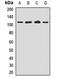 MTSS I-BAR Domain Containing 1 antibody, orb411876, Biorbyt, Western Blot image 