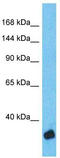 Zinc Finger Protein 134 antibody, TA342118, Origene, Western Blot image 