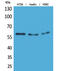 Cytochrome P450 Family 11 Subfamily B Member 1 antibody, STJ96589, St John