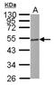 Tubulin Beta 4B Class IVb antibody, NBP2-14887, Novus Biologicals, Western Blot image 