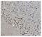 Mitogen-Activated Protein Kinase 11 antibody, A03738-1, Boster Biological Technology, Immunohistochemistry paraffin image 