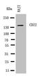 CD22 Molecule antibody, LS-C312263, Lifespan Biosciences, Western Blot image 