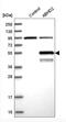 Abhydrolase Domain Containing 2 antibody, NBP1-82850, Novus Biologicals, Western Blot image 
