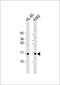 Small Nuclear Ribonucleoprotein D1 Polypeptide antibody, GTX81985, GeneTex, Western Blot image 