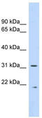 Calpain Small Subunit 1 antibody, TA344345, Origene, Western Blot image 