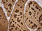 Thyroglobulin antibody, LS-C340637, Lifespan Biosciences, Immunohistochemistry frozen image 