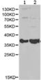 MNAT1 Component Of CDK Activating Kinase antibody, TA324025, Origene, Western Blot image 