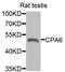 Carboxypeptidase A6 antibody, PA5-76949, Invitrogen Antibodies, Western Blot image 