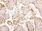 NME/NM23 Nucleoside Diphosphate Kinase 1 antibody, LS-C796838, Lifespan Biosciences, Immunohistochemistry paraffin image 