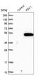 Pyruvate Dehydrogenase Kinase 1 antibody, HPA027376, Atlas Antibodies, Western Blot image 