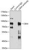 Chromobox 4 antibody, A03388-2, Boster Biological Technology, Western Blot image 