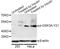 Glycogen Synthase Kinase 3 Alpha antibody, STJ29348, St John