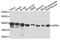 Nucleophosmin 1 antibody, STJ110969, St John