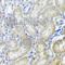 Histone Deacetylase 6 antibody, A1732, ABclonal Technology, Immunohistochemistry paraffin image 