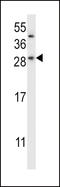 Charged multivesicular body protein 2b antibody, LS-C168739, Lifespan Biosciences, Western Blot image 